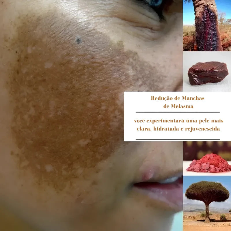 Creme Coreano - Tratamento Milenar para Melasma e Hidratação