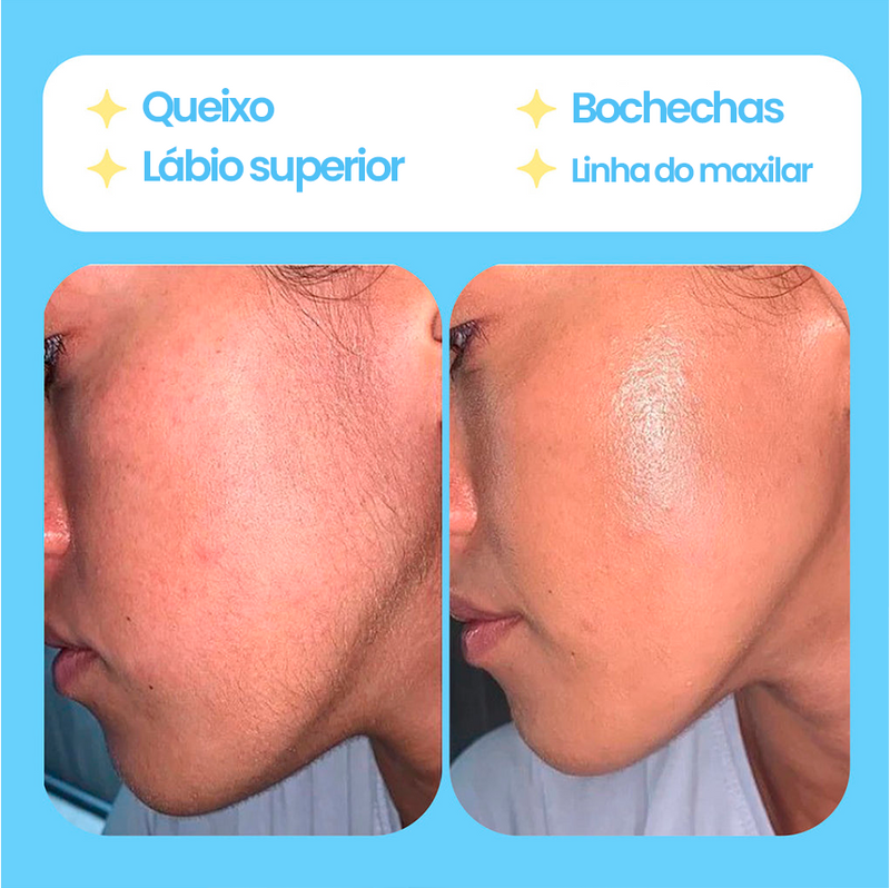 HeroDepilator™ Removedor de pelos faciais